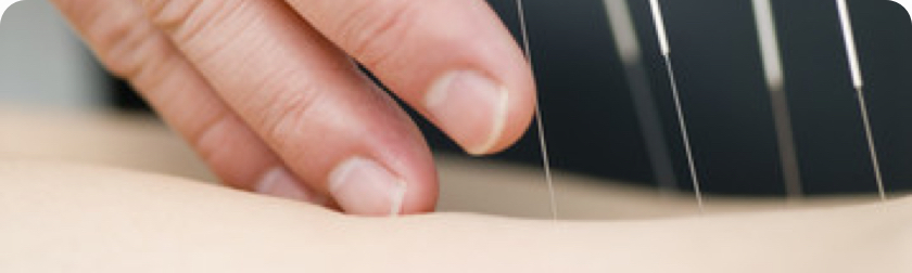Acupuncture | Bob’s Traditional Body Rehabilitation Centre